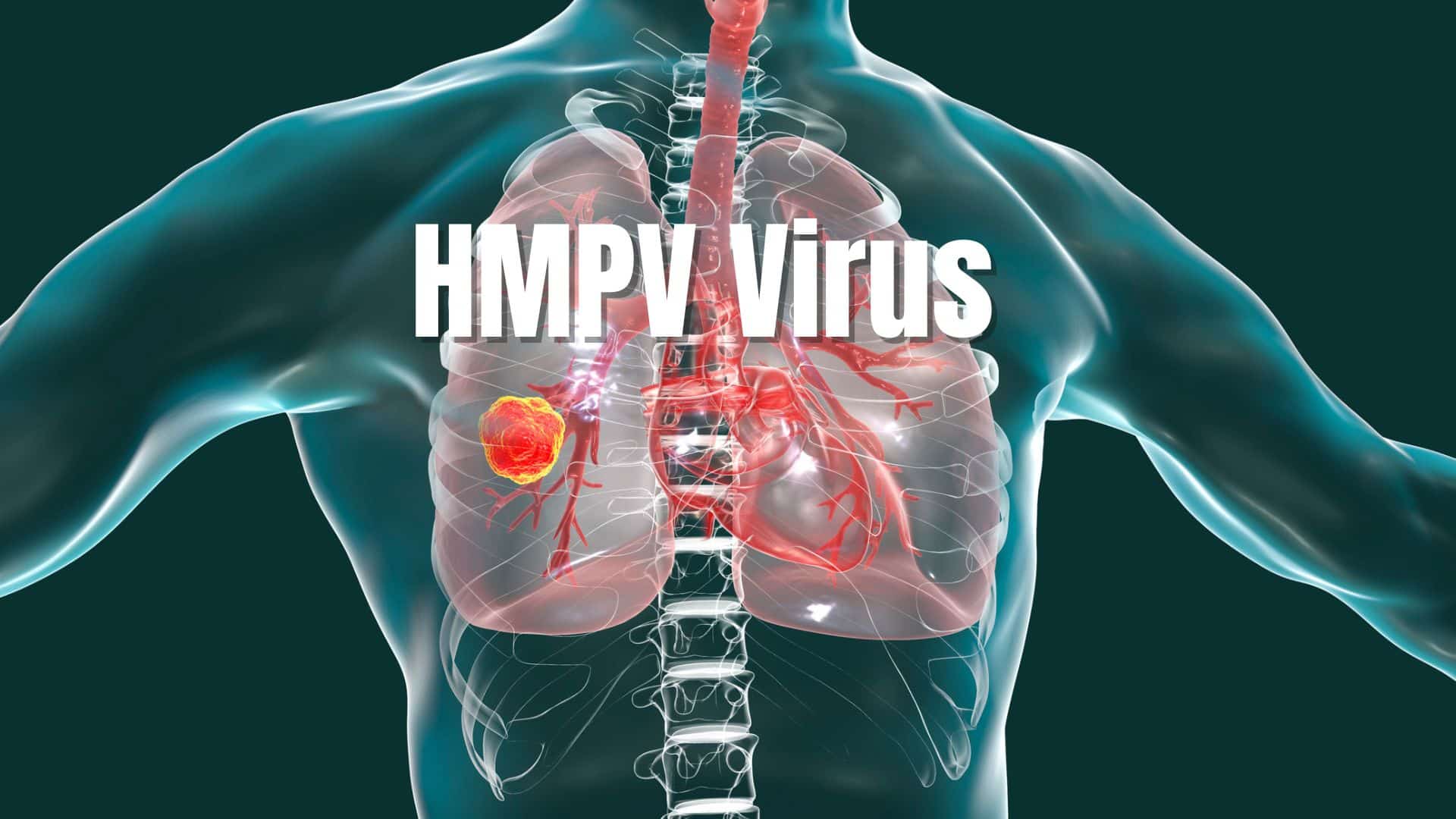 HMPV: A Respiratory Illness You Need to Know About