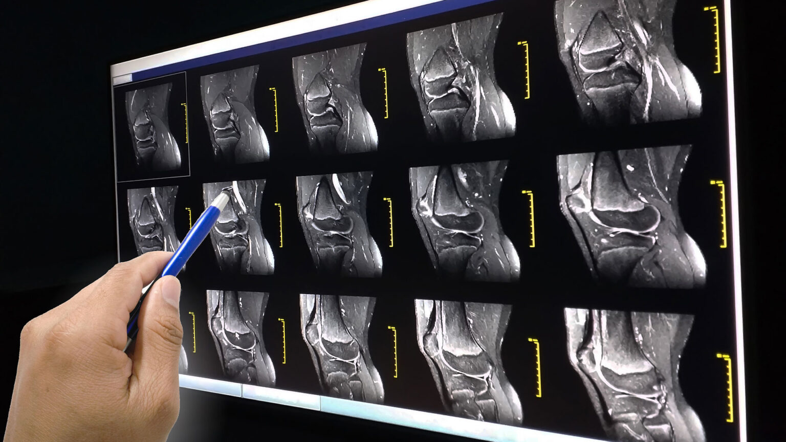 Extremity MRI St. Michael's Elite Hospital
