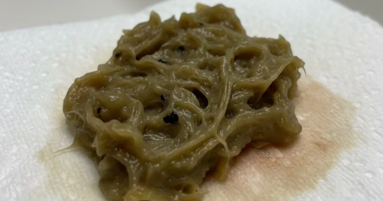 Brown mucus with a stringy, slimy texture.