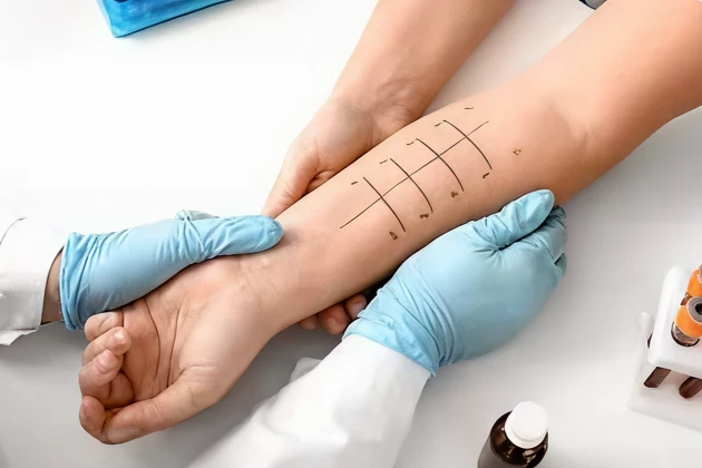 Allergy Treatment in Sugar Land