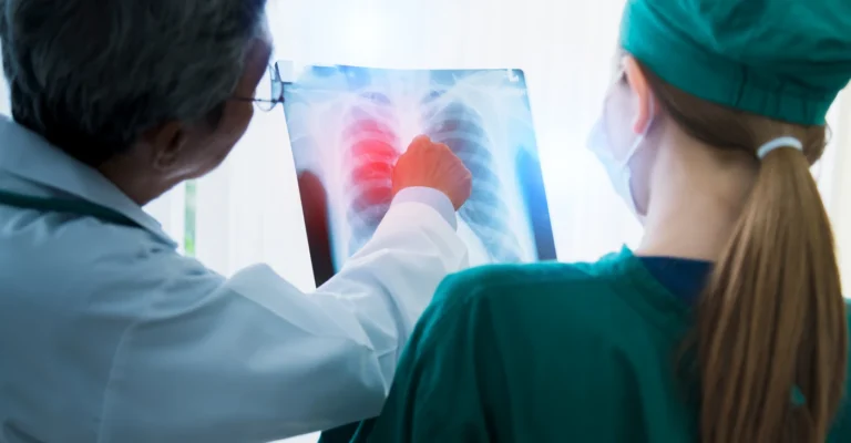 asian-doctor-team-examine-xray-film-patient